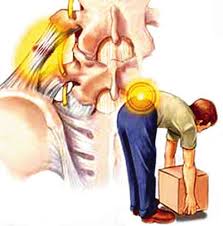 Image of Low back pain cause by San Diego Chiropractors, Massage. Our chiropractors give special treatment to spine, joint, muscles, tendons, ligaments and nerves.