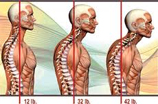 Pain relief and Treatment for posture of Migraine and Headache sufferers by chiropractors of San Diego Chiropractic and Massage, we are located in the Mira Mesa