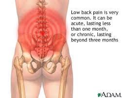 Low back pain relief diagram by San Diego Chiropractors, Massage. Our chiropractors give special treatment to spine, joint, muscles, tendons, ligaments and nerves.