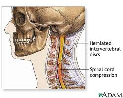 Vertebrae image - San Diego Chiropractic, Massage specialize in pain relief and treatment of brain, neck vertebrae, spine and nerves utilizing various techniques to achieve optimal results.