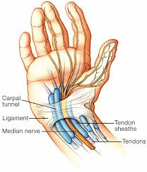 Carpel Tunnel Syndrome pain relief offered by Chiropractors of San Diego Chiropractic Massage.